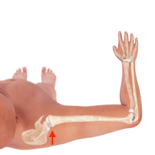 Illustration of an arm in the first 50 percent 