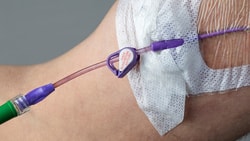 Close-up of an arm with a catheter and connectors, secured with white tape, for medbridge use.