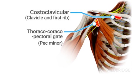 Anatomy diagram of the costoclavicular and thoraco-coraco-pectoral areas around the shoulder and rib, ideal for medbridge healthcare training.