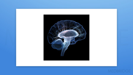 An X-ray style digital image of a human brain highlighting neural pathways on a black background for medbridge.