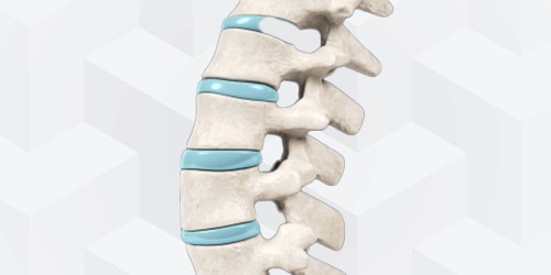 Illustration of a human lumbar spine with vertebrae and blue discs on geometric background, perfect for medbridge.