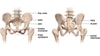 A labeled diagram of pelvic bones highlighting landmarks like the iliac crest and pubic symphysis, used for medbridge healthcare education.