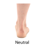 A bare foot from behind showing the heel and Achilles tendon, used in digital healthcare by medbridge.