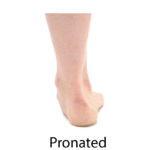 Bare heel slightly lifted against a white background, symbolizing medbridge's precise digital healthcare solutions.