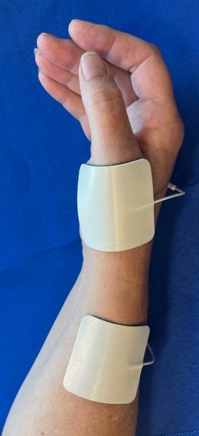 A forearm with two adhesive electrodes on a blue surface, connected by wires.