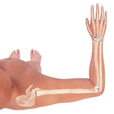 An illustration of a human arm highlighting the skeletal structure for healthcare education on medbridge.