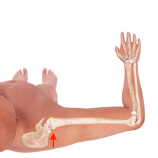 Illustration of a human arm showing elbow function, used for medbridge healthcare training.