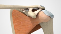 Illustration of the shoulder joint with exposed bones and muscles, featured in a medbridge module.