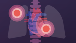 Illustrated heart and lungs with target circles on a dark Medbridge background.