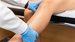 anterior drawer test