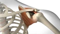 Diagram of a shoulder joint displaying bones and surrounding tissues, by Medbridge.