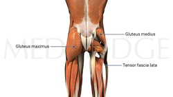 Diagram of human gluteal muscles with labels for gluteus maximus, gluteus medius, and tensor fascia lata from medbridge.