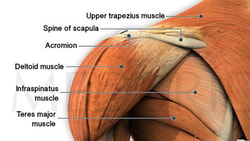 Illustration showing the shoulder muscles, including the trapezius sections, deltoid, infraspinatus, teres major, acromion, and scapula spine for medbridge.