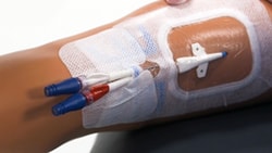 A medbridge medical mannequin leg with IV catheters in a pad for venipuncture training.