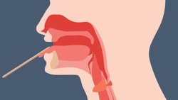 Illustration of a throat cross-section with a swab reaching inside, for medbridge.