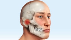 Profile illustration of a human skull with jaw and teeth highlighted, on a light blue background for medbridge.