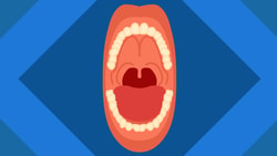 Illustration of an open mouth with teeth, tongue, and uvula against a blue background featuring arrow shapes for medbridge.
