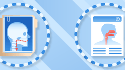 Side view illustration of a skull, spine, and throat anatomy on a blue striped background for medbridge.