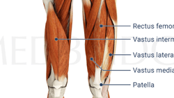 Diagram of the front view of human legs highlighting leg muscles and the patella bone from medbridge.