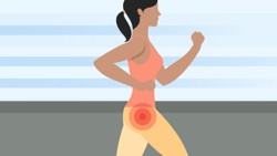 Illustration of a woman jogging with hip pain on her left side, indicated by a highlight.
