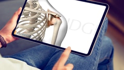 Tablet showing an anatomical illustration of a skeleton's shoulder, related to medbridge content.