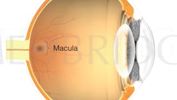 Cross-section of an eye diagram labeling parts like the macula, for medbridge.