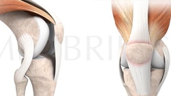 An anatomical illustration of a human knee joint showing side and front views with muscles, tendons, and bones highlighted for Medbridge.
