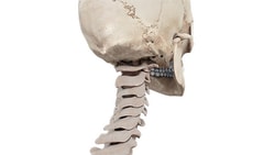 Side view of a skull and neck vertebrae illustrating cervical spine alignment for medbridge.