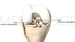 Illustration of a knee joint with labeled ACL and PCL on medbridge platform.