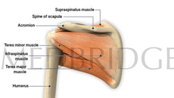 Diagram of shoulder anatomy with humerus, acromion, spine of scapula, and muscles including supraspinatus, teres minor, infraspinatus, teres major for a medbridge course.