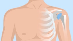 Illustration of a human upper body with ribs, heart, lungs, and a pacemaker near the left shoulder on a blue background.