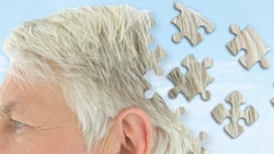 Illustration of an older man's head with puzzle pieces dispersing, symbolizing memory loss, on a blue sky background for medbridge.