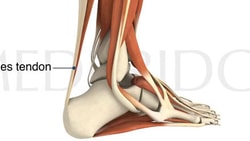 Diagram of the Achilles tendon linking calf muscles to the heel.