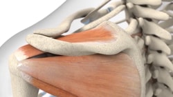Illustration of shoulder muscles and bones, including scapula, humerus, and clavicle, from medbridge.