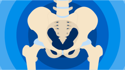 Illustration of a human pelvic bone on blue concentric circles, designed for medbridge.