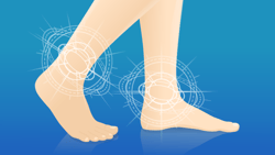 Illustration of feet with glowing ankle designs on a blue Medbridge background.