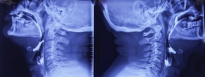 Side-by-side lateral X-rays show different neck positions for medbridge healthcare training.