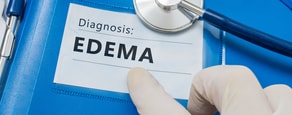 A gloved hand points to a medical document labeled "Diagnosis: EDEMA" on a blue clipboard next to a stethoscope, highlighting medbridge digital healthcare tools.