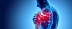 Medbridge illustration of a person with a painful red-highlighted shoulder against a blue background.