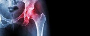 X-ray of a left hip joint with a red highlight, used in digital healthcare through medbridge.