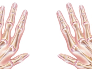 Illustration of skeletal hands from Medbridge on a white background.