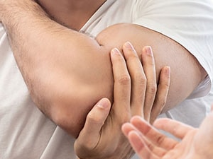 Man holding his elbow in pain during a consultation, possibly recovering from a bicep tendon rupture or repair.