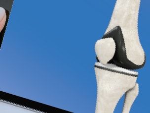 Someone holds a tablet showing a knee joint model in Medbridge on blue.