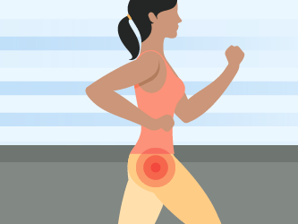Illustration of a woman jogging with hip pain on her left side, indicated by a highlight.