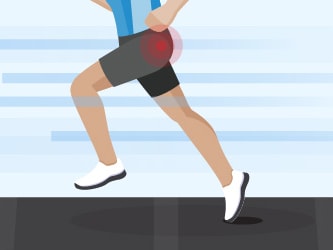 Medbridge illustration of a runner on a treadmill with emphasis on the knee.