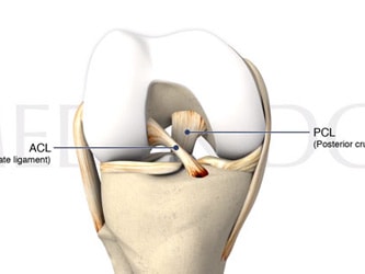 Illustration of a knee joint with labeled ACL and PCL on medbridge platform.