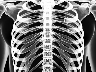 X-ray of a chest showing ribs, spine, and shoulders on a black background.