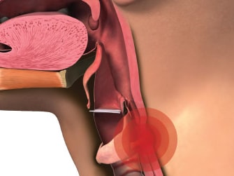 Diagram showing a red circle highlighting the voice box (larynx) in the throat.