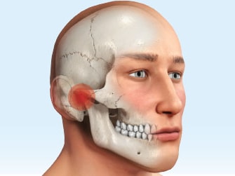 Profile illustration of a human skull with jaw and teeth highlighted, on a light blue background for medbridge.