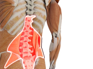 Medbridge illustration showing human torso with highlighted spine and abdominal muscles.